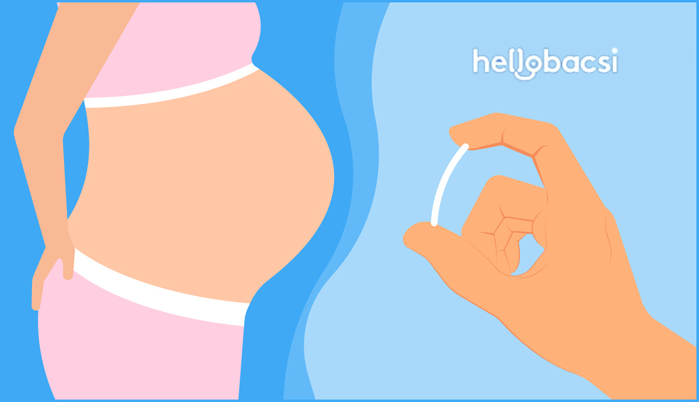 Cấy que tránh thai vẫn có thai có nguy hiểm không? Nguyên nhân và cách xử lý