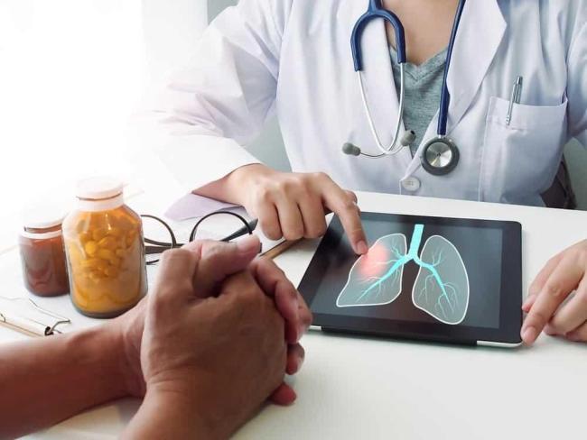 Nấm phổi có lây không? Tiên lượng khi mắc nấm phổi