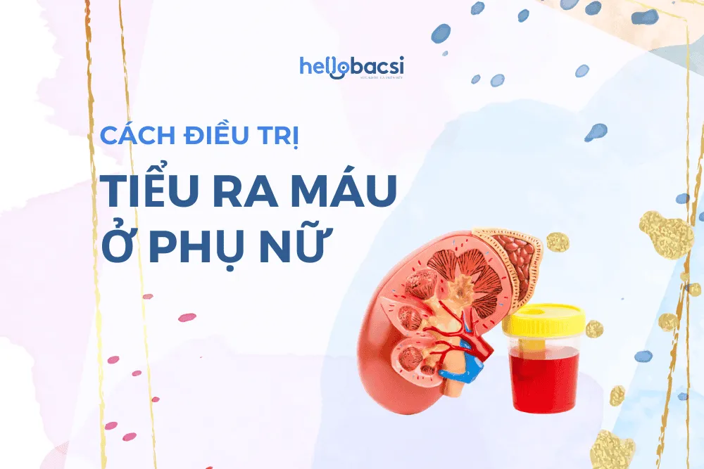Tham khảo ngay 8 cách điều trị đi tiểu ra máu ở phụ nữ