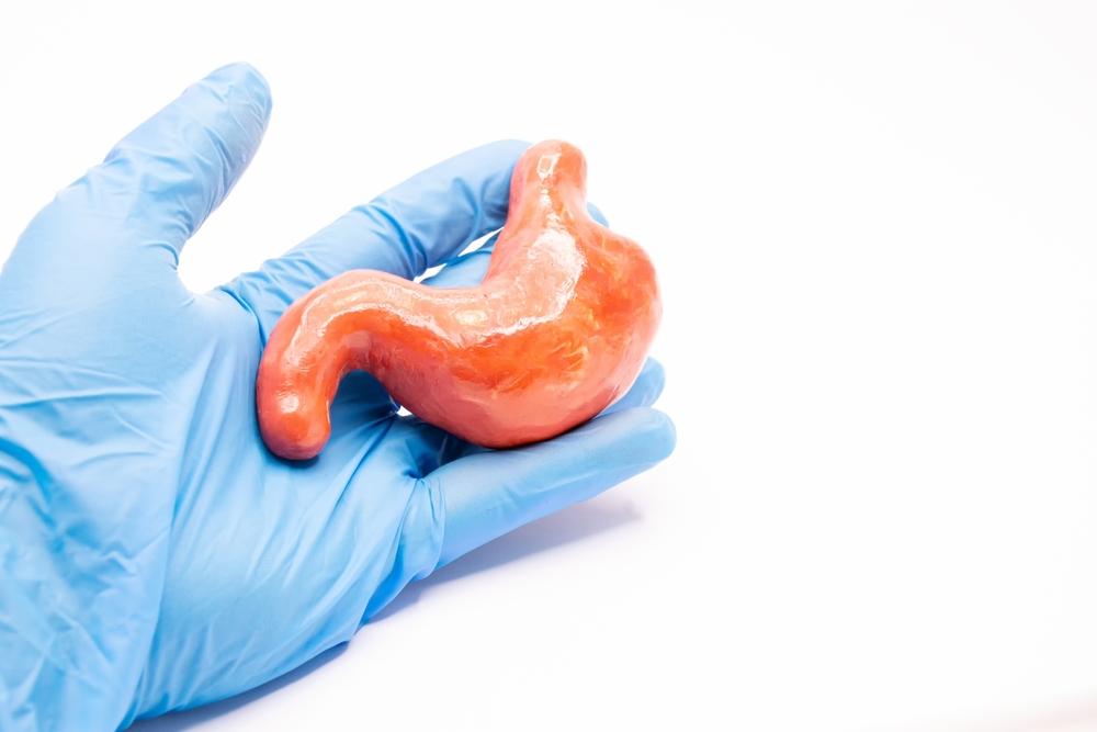 Xuất huyết dạ dày: Triệu chứng, nguyên nhân và cách điều trị