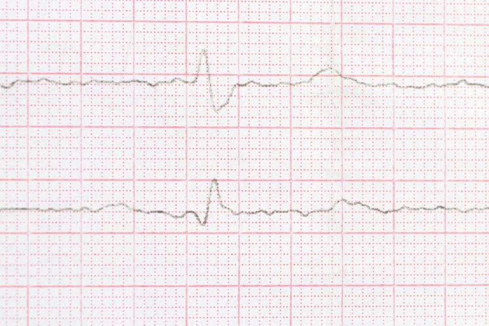Block nhánh trái và những thông tin bạn cần biết