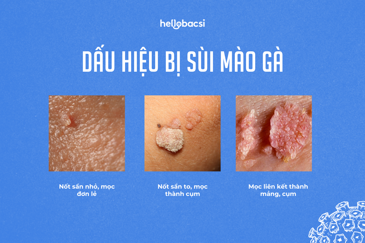 HPV lây qua đường nào