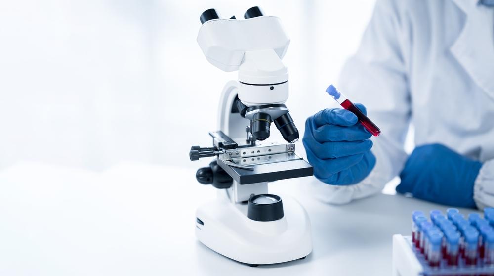 Bệnh tăng tiểu cầu có phải là ung thư máu không?