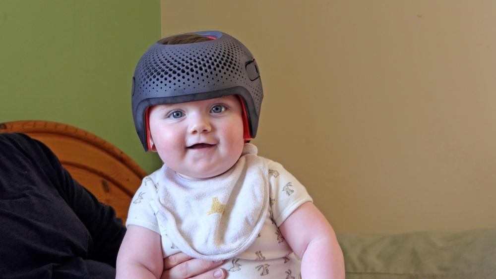 Mẹo đụng đầu vào tường chữa méo đầu cho trẻ sơ sinh có như lời đồn?