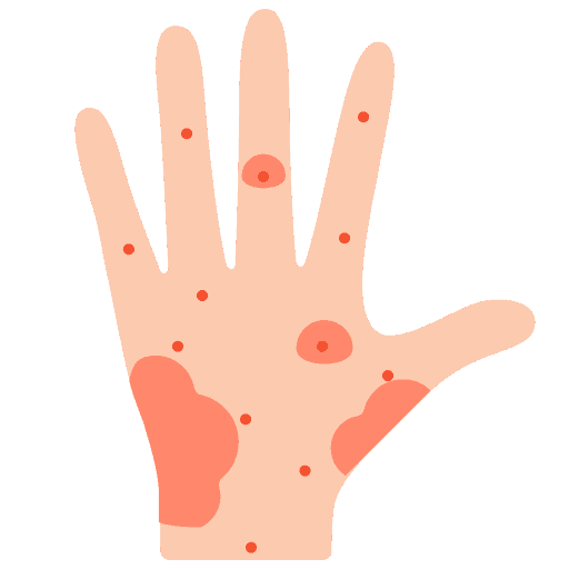 Vấn đề về da