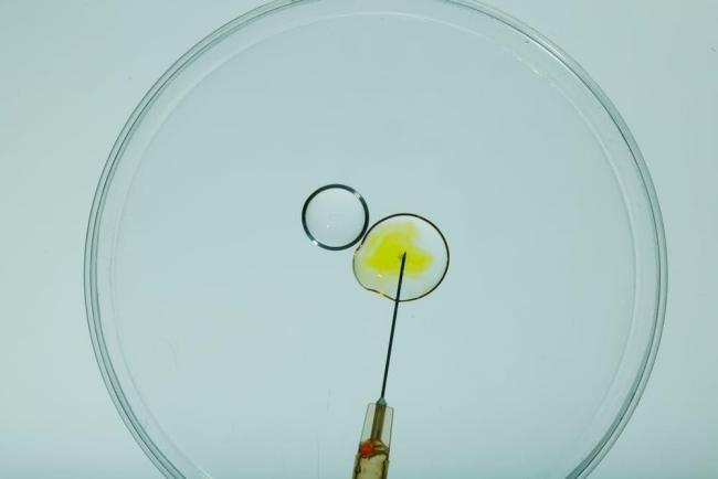 Mini IVF: Phương pháp giúp hành trình làm cha mẹ dễ dàng hơn