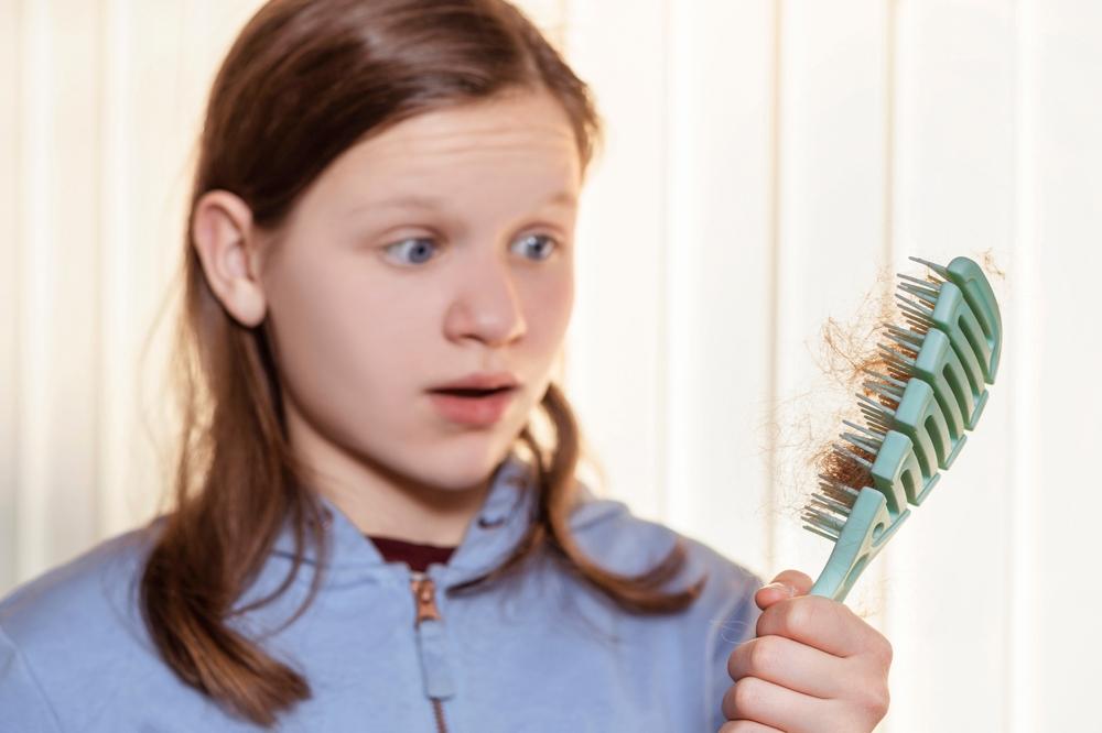 Bị rụng tóc ở tuổi dậy thì có sao không? Làm thế nào để ngăn ngừa?