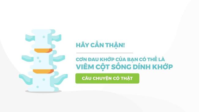 hay-can-than-con-dau-khop-cua-ban-co-the-la-viem-cot-song-dinh-khop