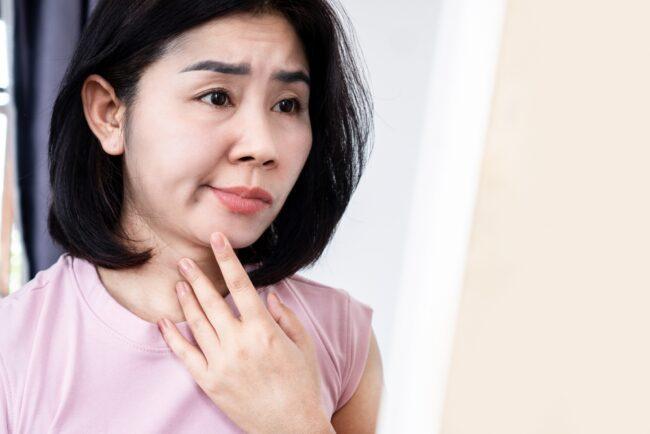 Liệt dây thần kinh số 7, cách chữa liệt dây thần kinh số 7 theo Đông y