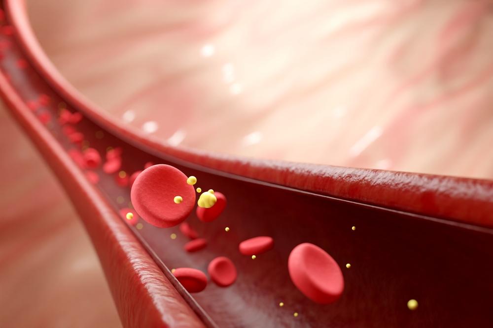 Cholesterol thấp là như thế nào? Có nguy hiểm không?
