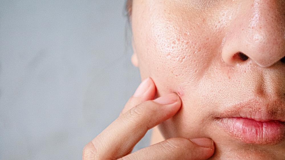 Top 15 loại serum se khít lỗ chân lông được đông đảo chị em tin dùng