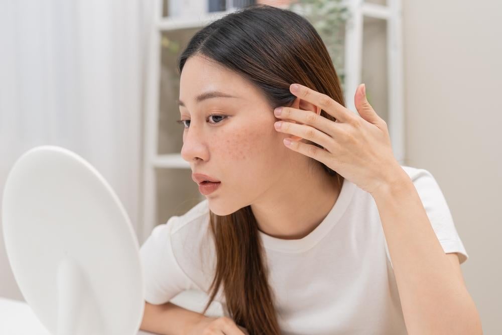 dấu hiệu nhận biết da nhạy cảm 