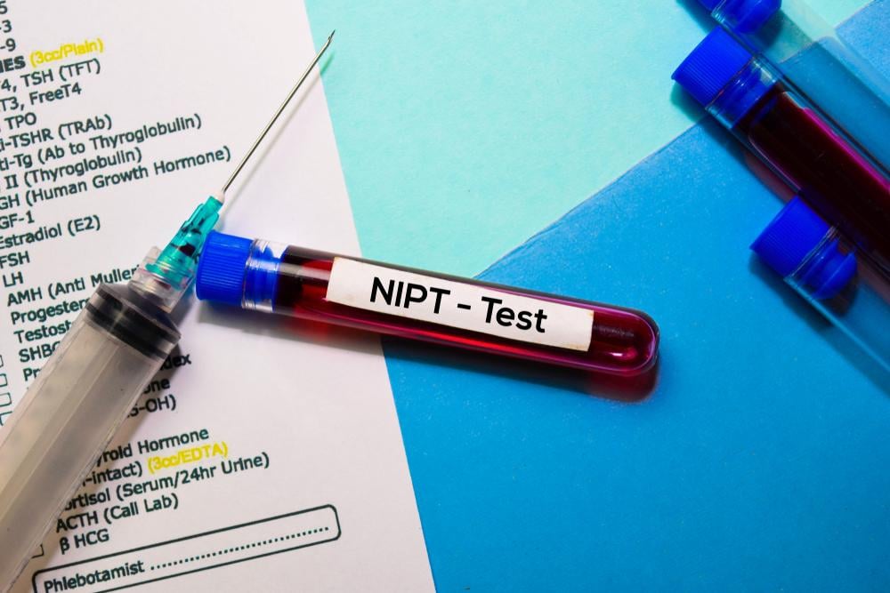Giá xét nghiệm nipt