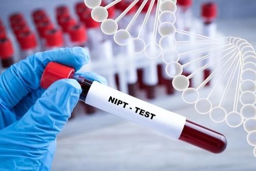 Cập nhật mới nhất 2025: Bảng giá xét nghiệm NIPT ở các bệnh viện lớn