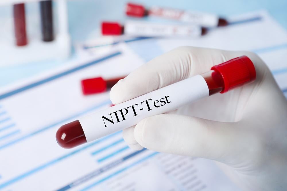 xét nghiệm nipt