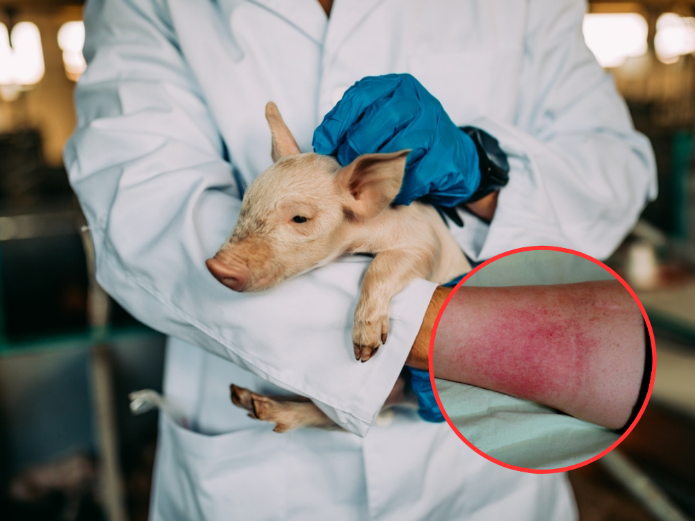 Bệnh liên cầu khuẩn ở lợn nguy hiểm như thế nào, cách phòng tránh?