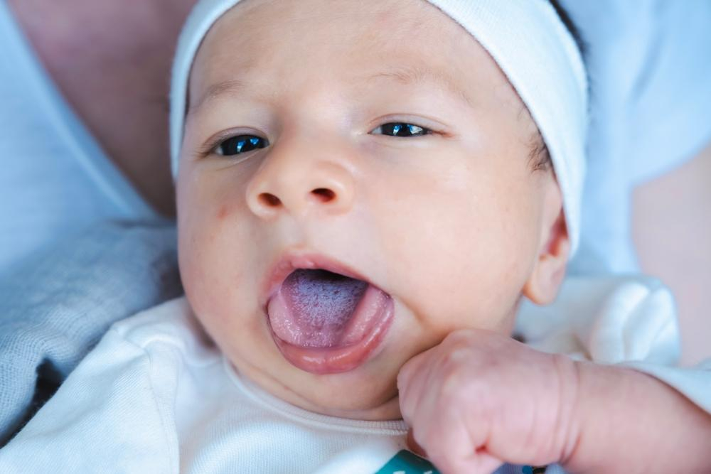 Cách chăm sóc trẻ sơ sinh bị tưa lưỡi để bé ăn ngoan, bú khỏe
