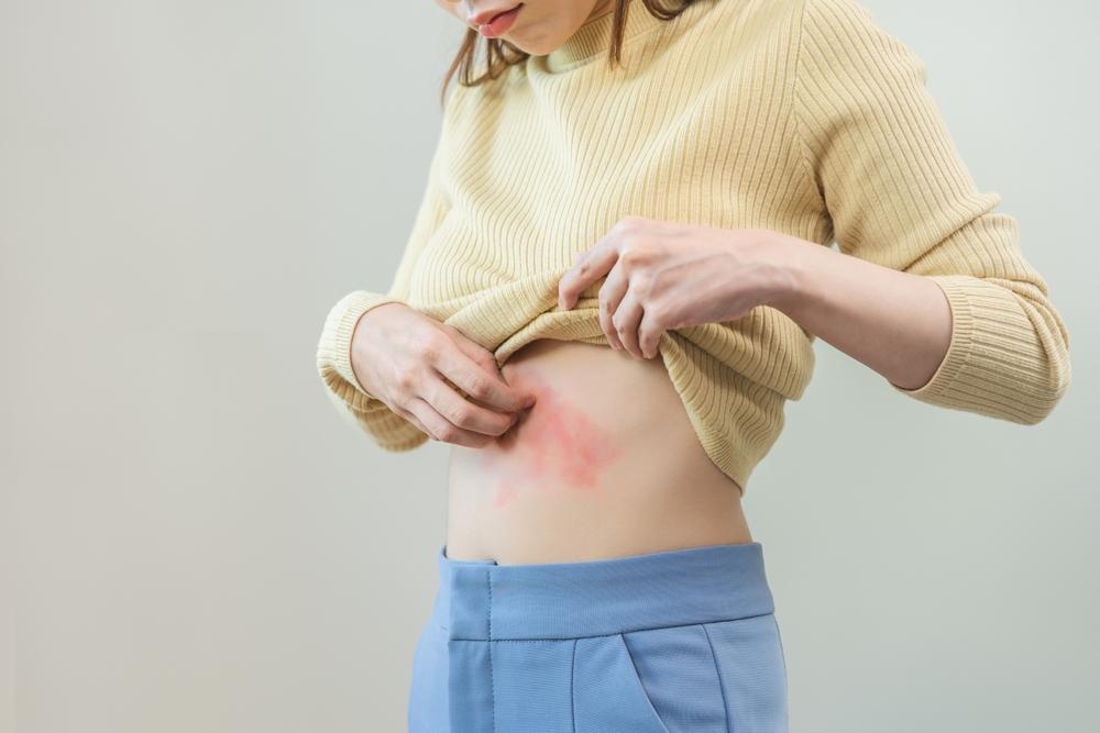 Bệnh zona thần kinh: Triệu chứng, điều trị và phòng ngừa