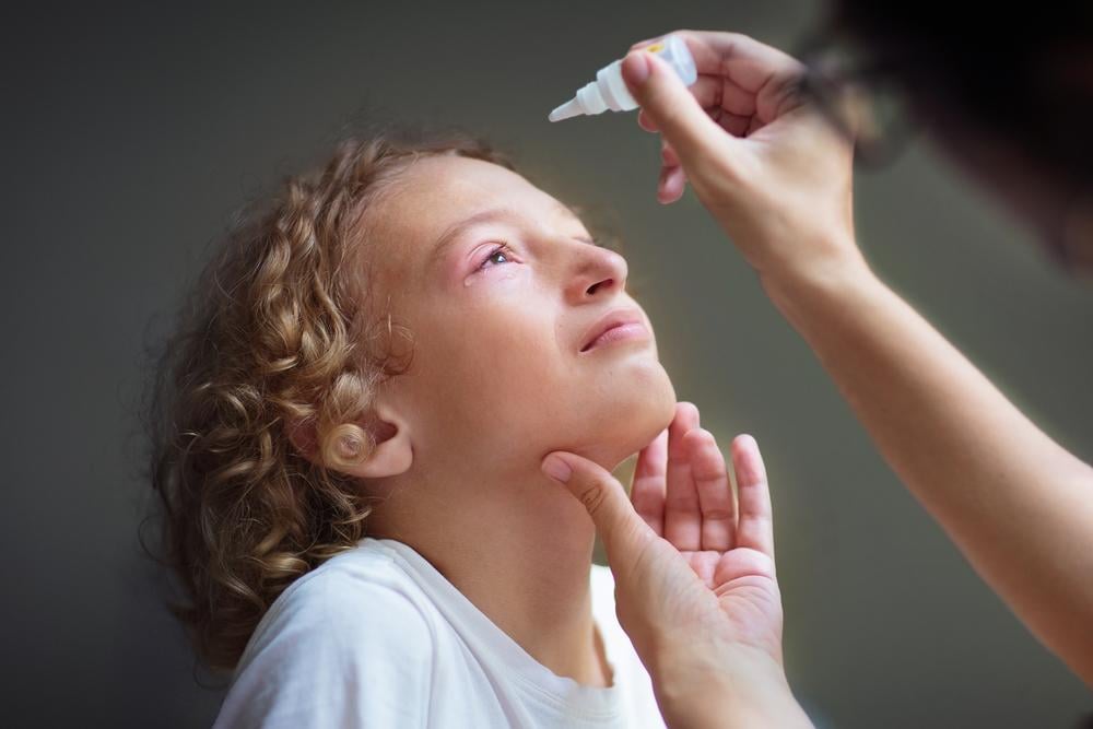 5 cách trị đau mắt đỏ tại nhà hiệu quả và những sai lầm cần tránh