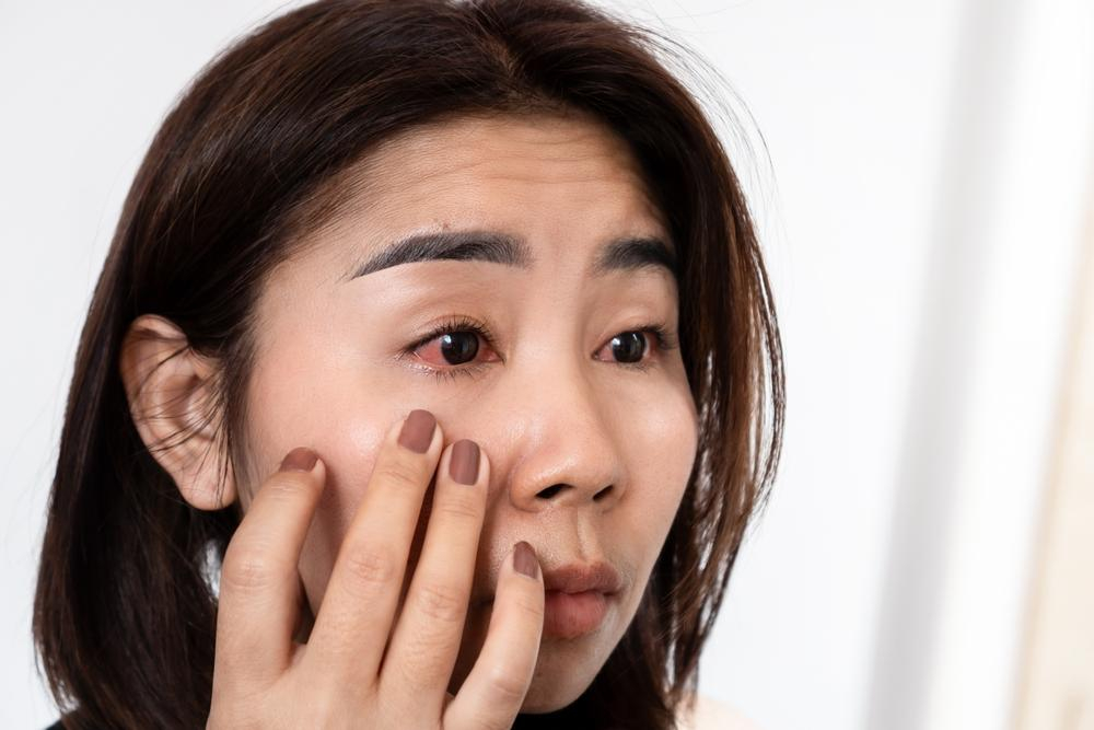 Những điều không nên làm khi trị đau mắt đỏ tại nhà