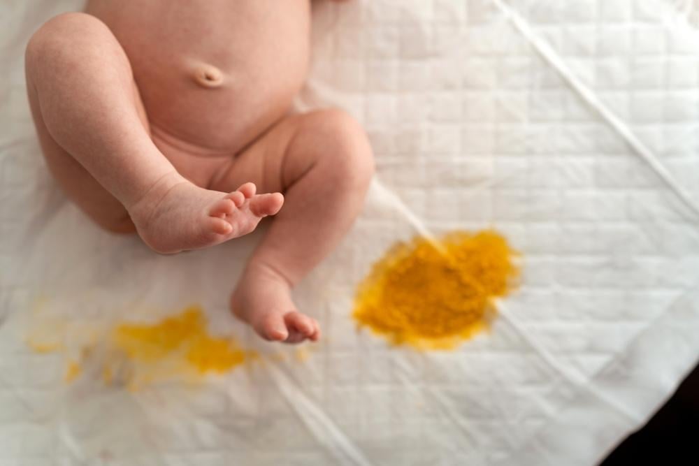 Nguyên nhân bệnh lý khiến trẻ sơ sinh đi ngoài ra nước vàng.