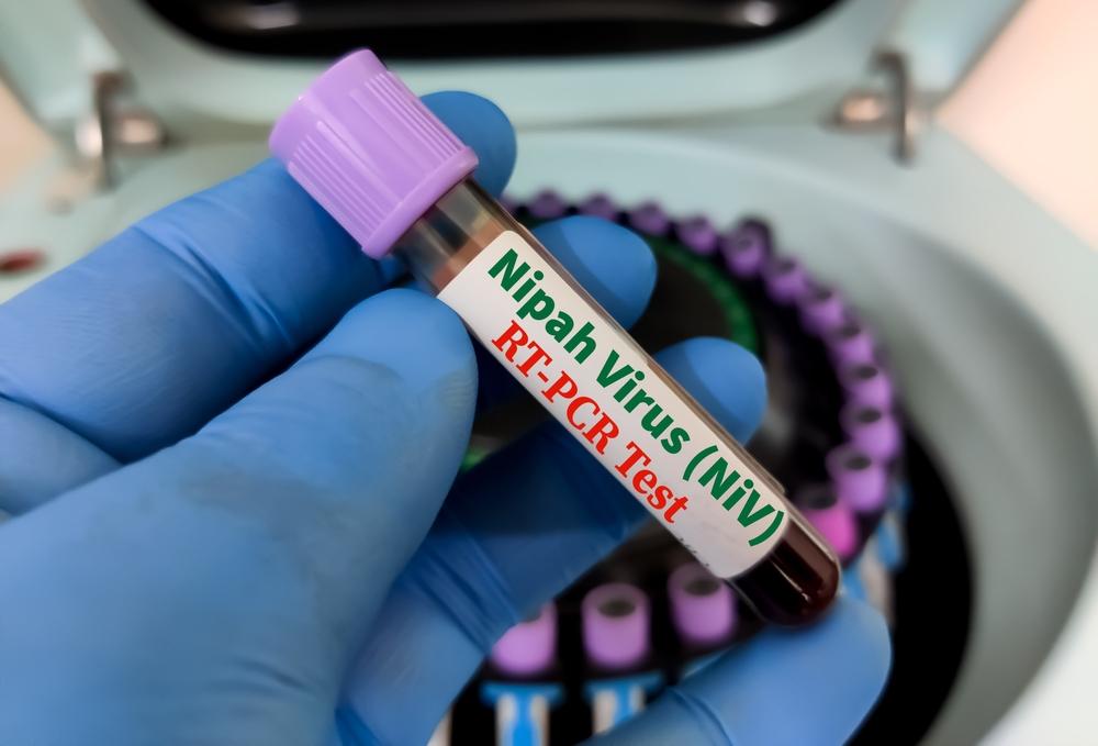 Virus Nipal