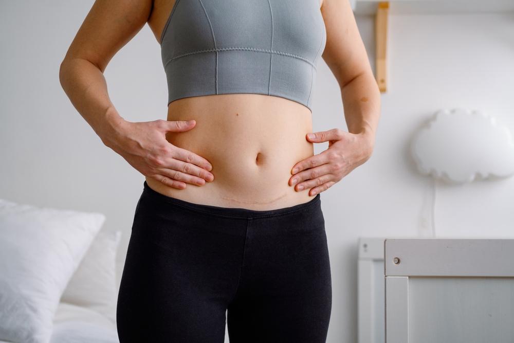 sau sinh mổ nên ăn gì