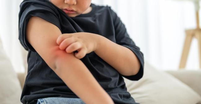 Trẻ bị nổi mẩn đỏ khi giao mùa: Bình thường hay biểu hiện cần lưu ý?