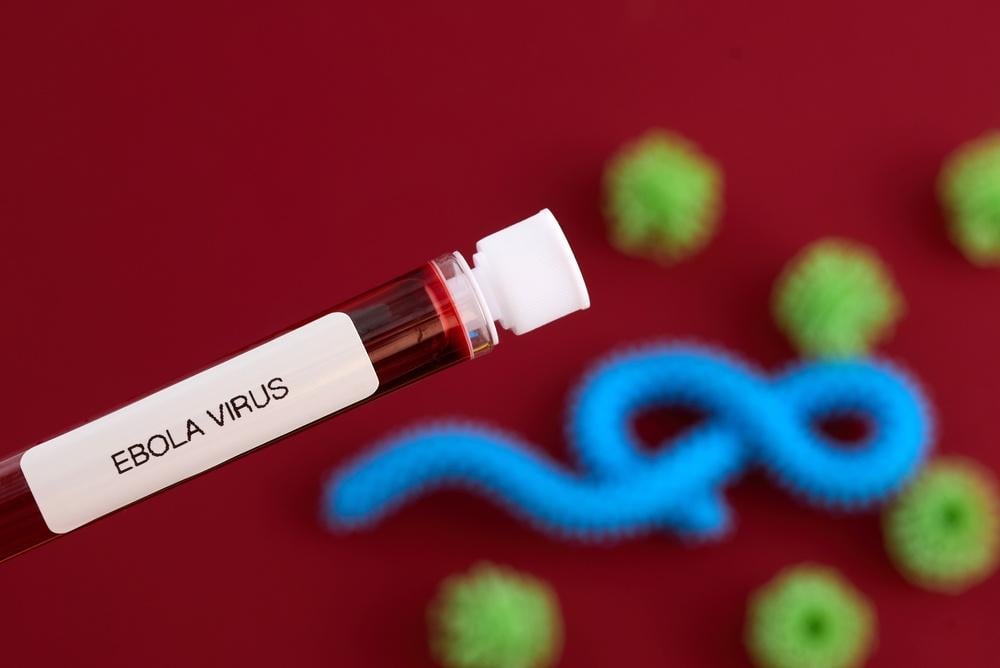 Ebola là bệnh gì? Mức độ nguy hiểm và cẩm nang phòng ngừa virus Ebola