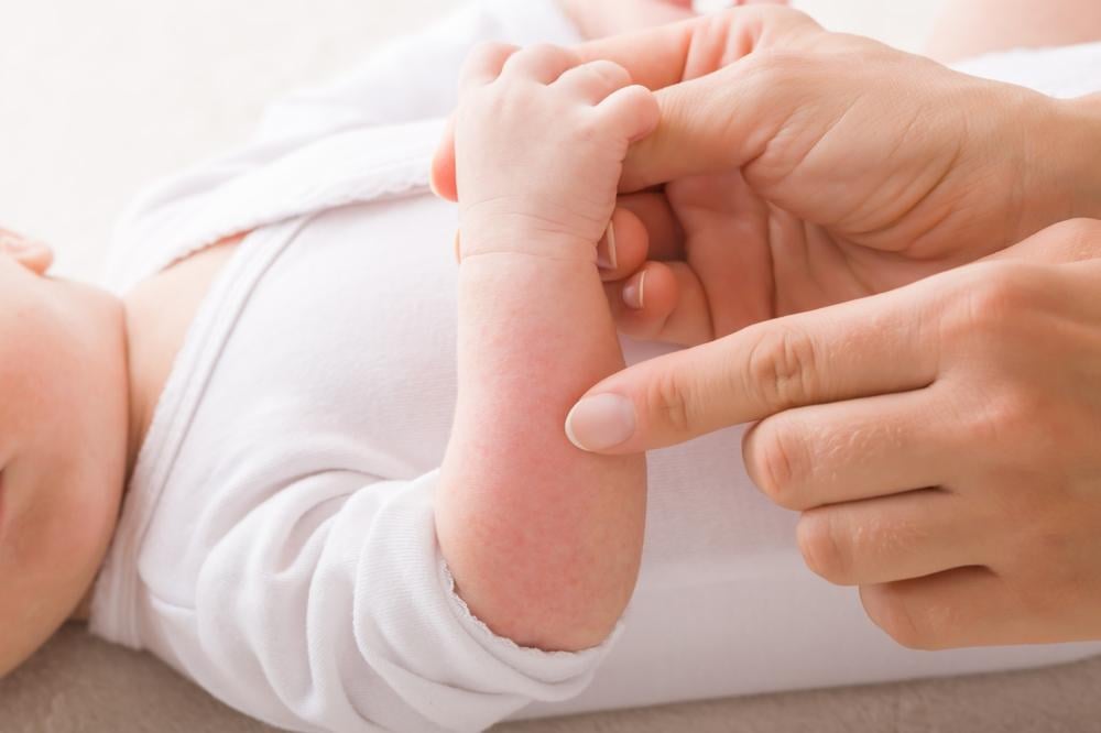 Nhà nội ngoại không ai dị ứng, sao con sinh ra vẫn mẫn cảm hay nguy cơ dị ứng?