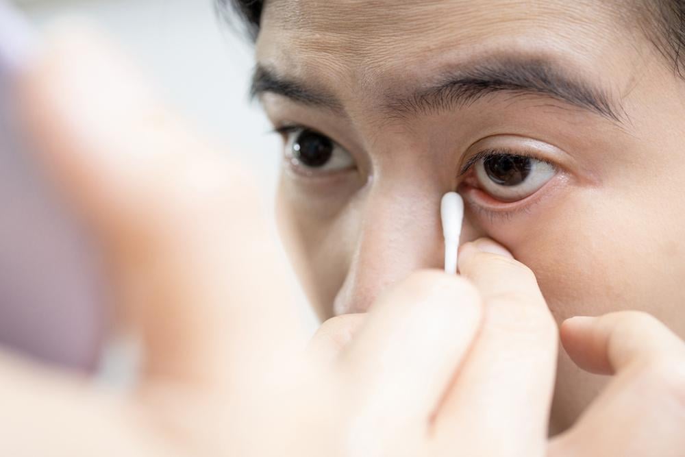 Quặm mi là gì? Điều trị quặm mi như thế nào?