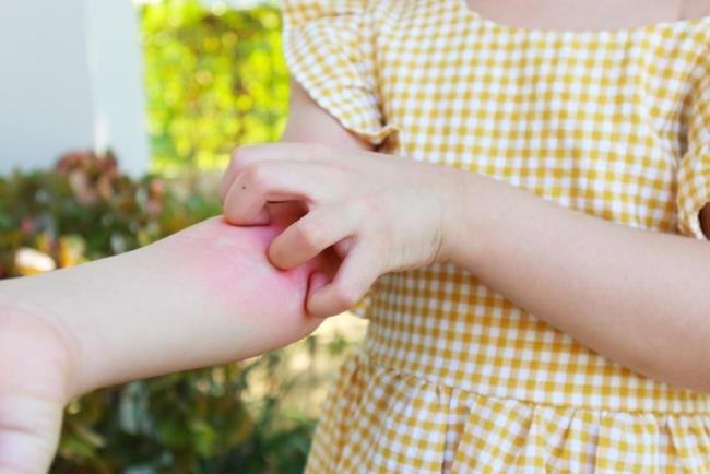 Giao mùa: Khi chiếc bụng quá tải phát tín hiệu "cầu cứu" ra làn da!