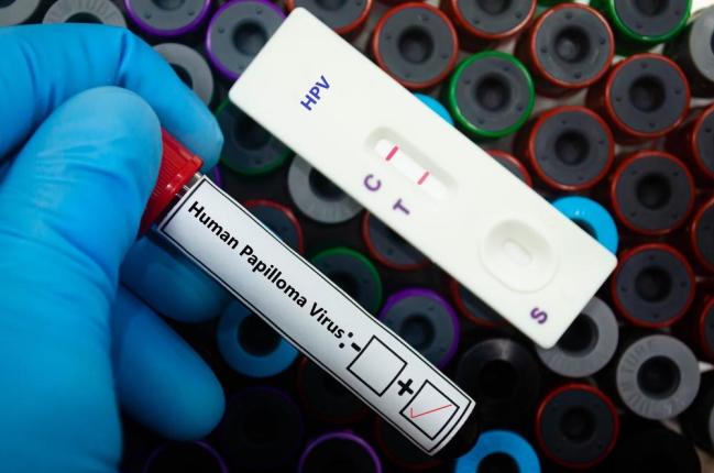 Dương tính HPV có phải đã mắc ung thư không?